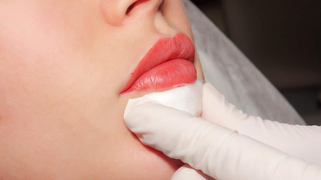 Tuzla Dudak Kontürü